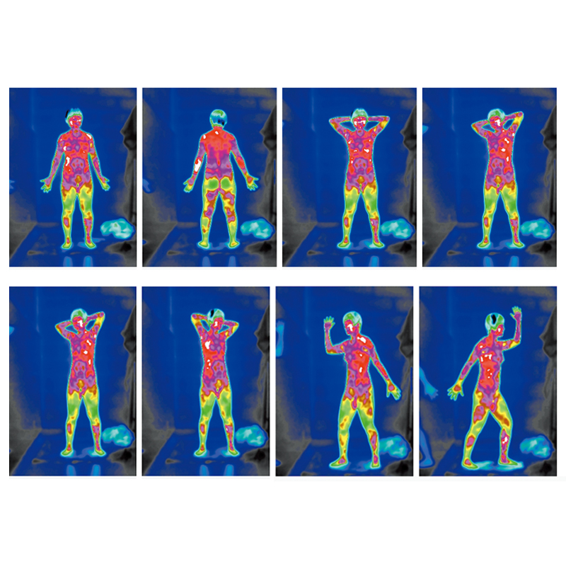 Medical Infrared Thermal Imager 2